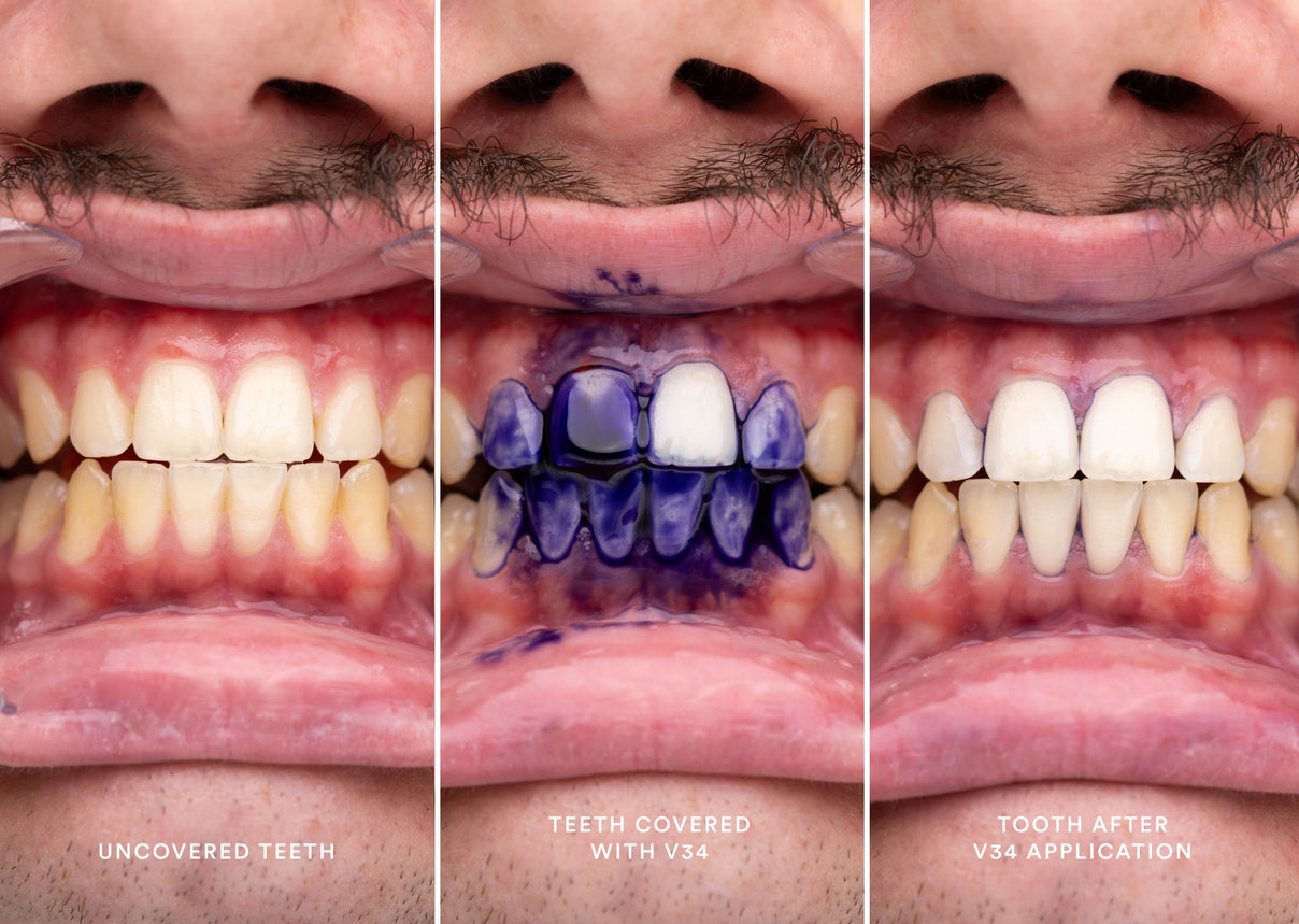 Hismile V34