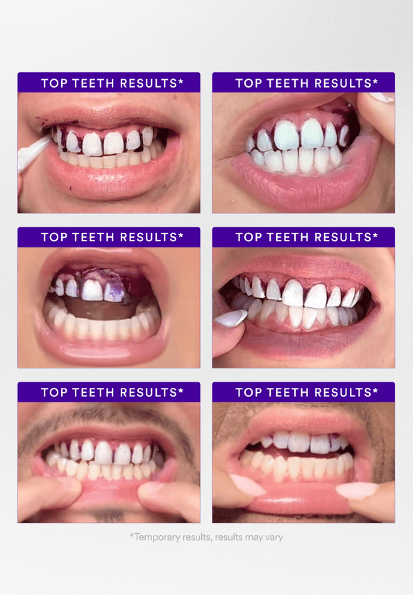 V34 Whitening Strips product carousel 4