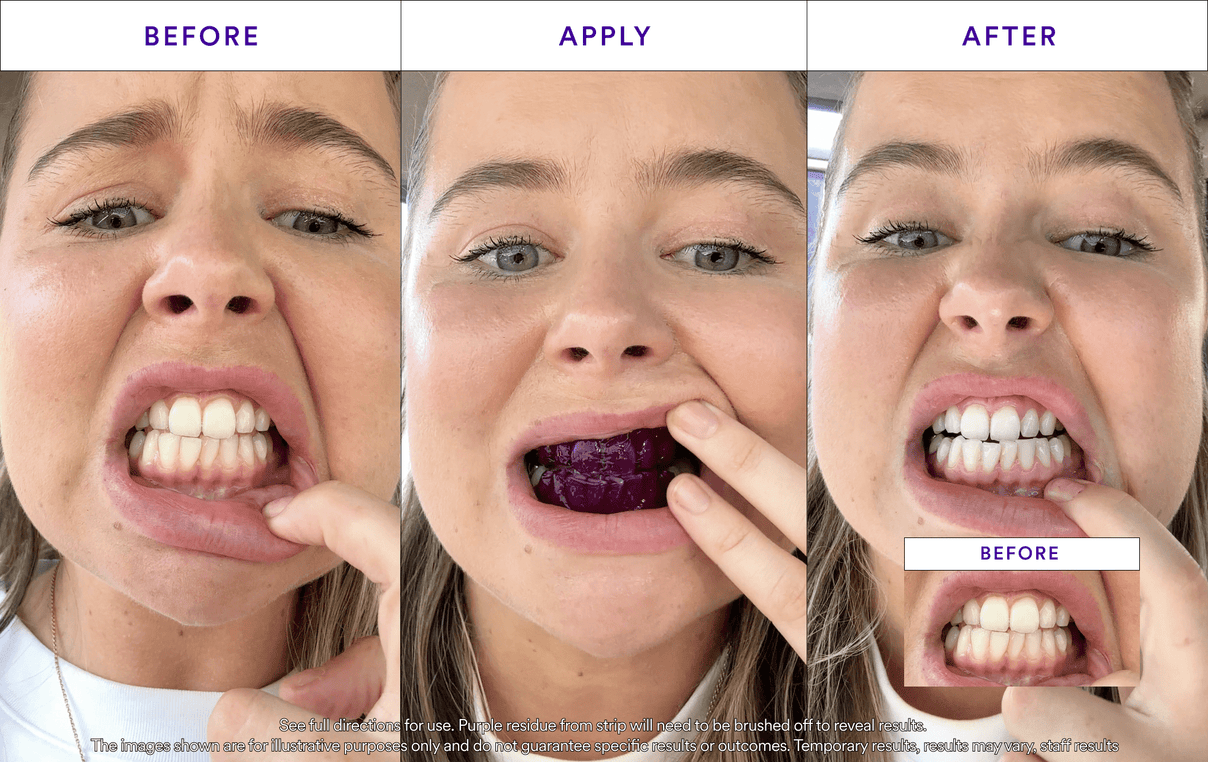 V34 Whitening Strips product carousel 6
